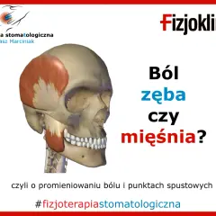 Anatomia czaszki z zaznaczonym mięśniem skroniowym. Pytanie: Ból zęba czy mięśnia? Może to być dziwny ból między zębami. #fizjoterapiastomatologiczna
