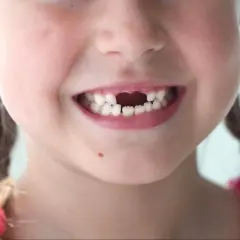 Uśmiechnięta dziewczynka z widocznym brakiem mleczaków. Zastanawiasz się, jak długo rusza się mleczak zanim wypadnie?