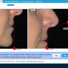 Analiza profilu twarzy, ocena prawidłowego ułożenia szczęki i żuchwy.
