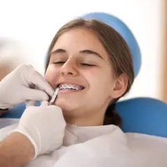 Uśmiechnięta dziewczyna z aparatem ortodontycznym, której dentysta delikatnie czyści zęby.