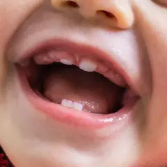 Uśmiechnięte dziecko z kilkoma ząbkami. Zastanawiasz się nad późne ząbkowanie przyczyny?