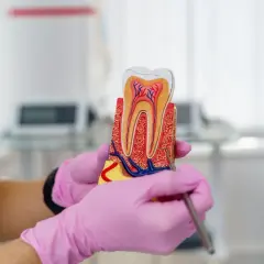 Model zęba w rękach w różowych rękawiczkach. Dentysta wyjaśnia, czy leczenie kanałowe jest bezpieczne, pokazując budowę zęba.