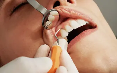 Dentysta wykonuje skaling, usuwając kamień nazębny. Widoczne narzędzia i zęby.