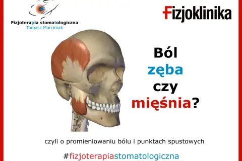 Anatomia czaszki z zaznaczonym mięśniem skroniowym. Pytanie: Ból zęba czy mięśnia? Może to być dziwny ból między zębami. #fizjoterapiastomatologiczna