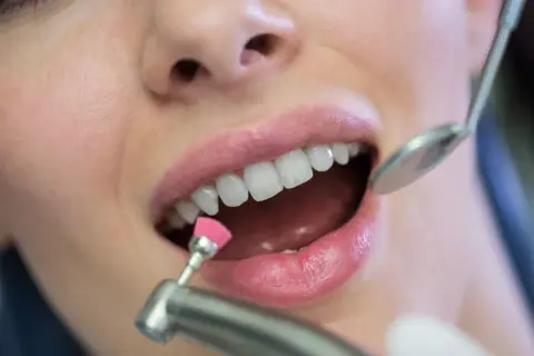 Zabieg polerowania zębów u dentysty. Czy lakierowanie zębów jest szkodliwe? Nie, to bezpieczna metoda higienizacji.