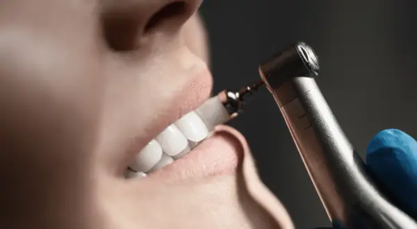 Zbliżenie na uśmiech pacjentki podczas zabiegu skaling zębów co to. Dentysta poleruje zęby.