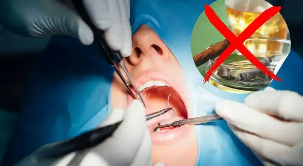 Znieczulenie u dentysty i alkohol? Obrazek pokazuje zabieg stomatologiczny i symbol zakazu alkoholu i papierosów.