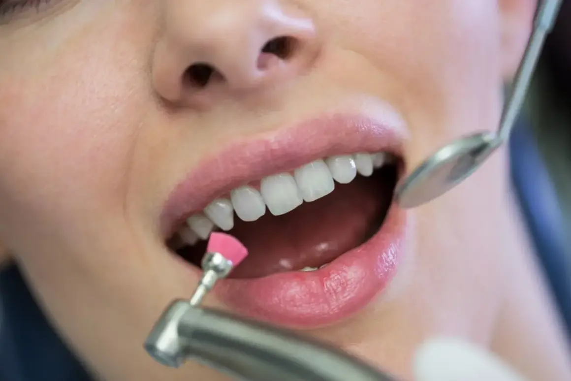 Zabieg polerowania zębów u dentysty. Czy lakierowanie zębów jest szkodliwe? Nie, to bezpieczna metoda higienizacji.