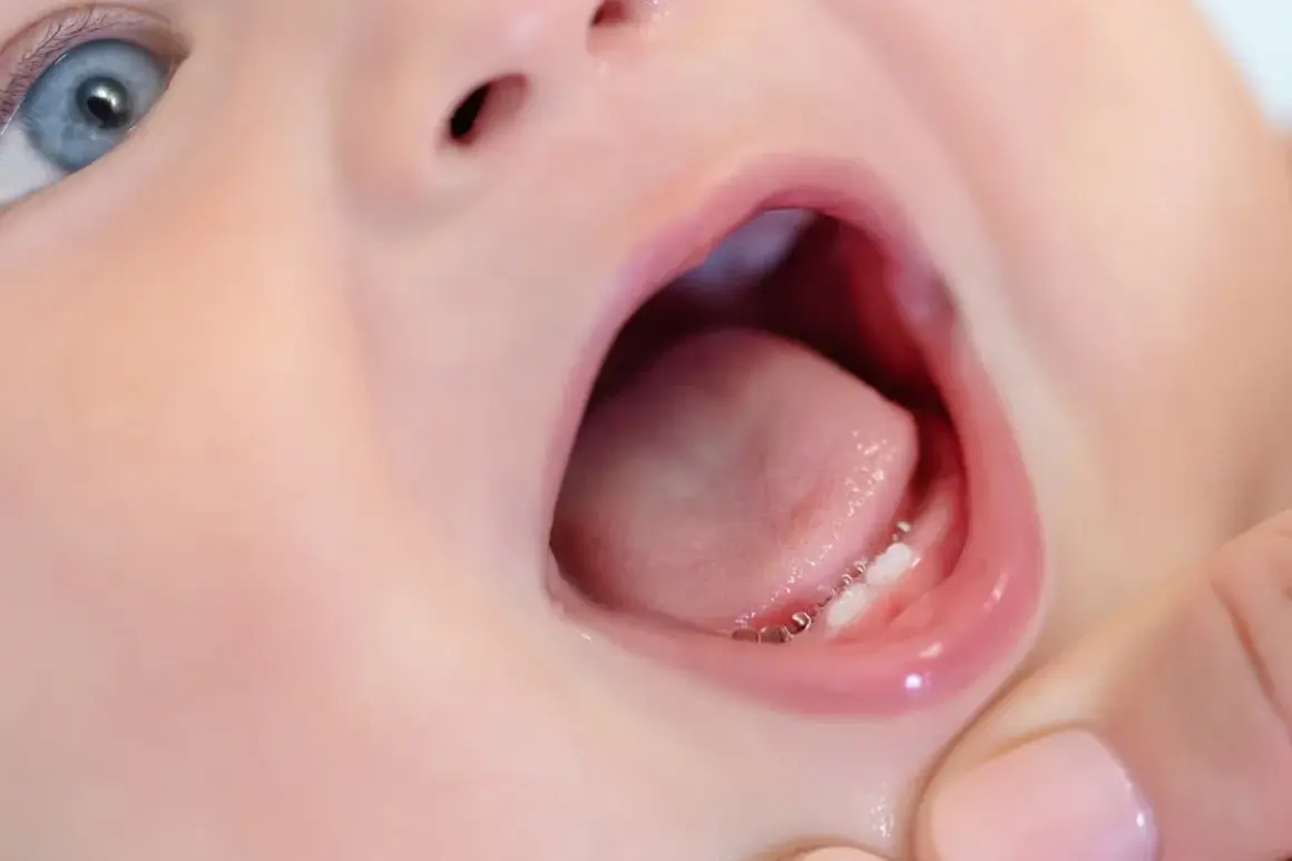 Malutkie, błyszczące ząbki. Roczne dziecko ma tylko 2 zęby, ale już widać ich uroczy blask.