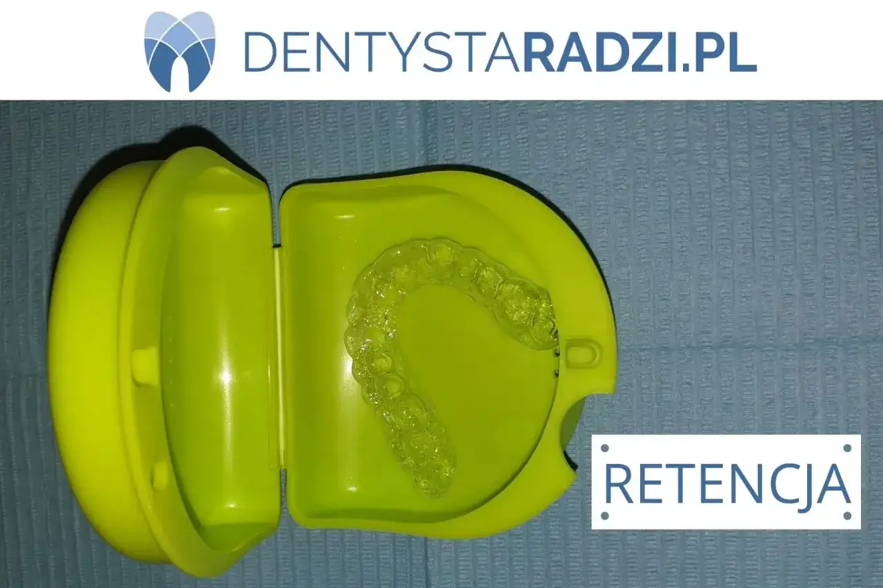 Przezroczysty aparat retencyjny w zielonym etui, idealny po aparacie stałym.