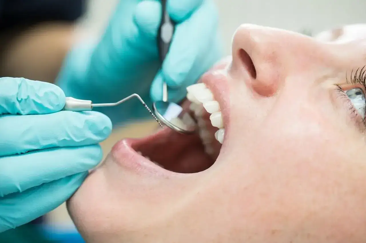 Dentysta w niebieskich rękawiczkach wykonuje fluoryzację zęb&oacute;w pacjentki, używając lusterka i narzędzia.