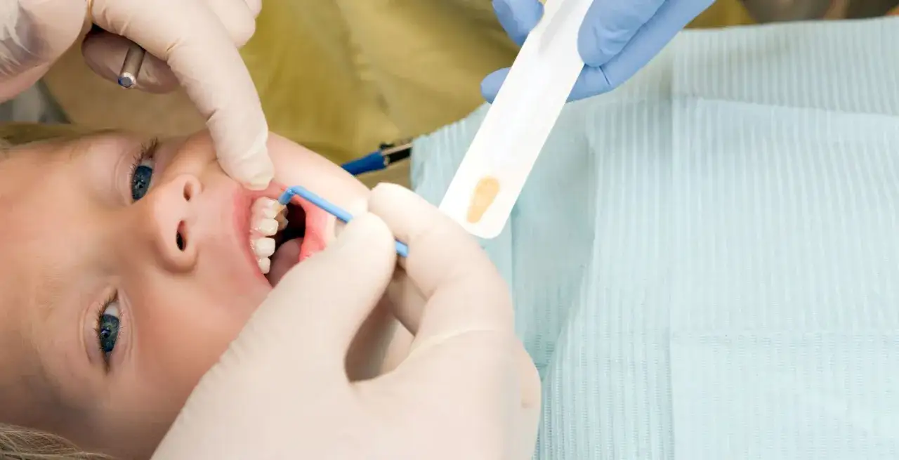 Dziecko u dentysty. Czy lakierowanie zębów jest szkodliwe? Specjalista aplikuje preparat na ząbki.