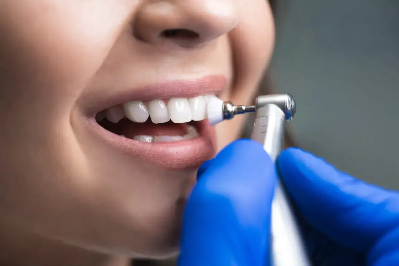 Profesjonalne piaskowanie zęb&oacute;w jak często? Dentysta delikatnie czyści zęby pacjentki specjalistyczną szczoteczką.
