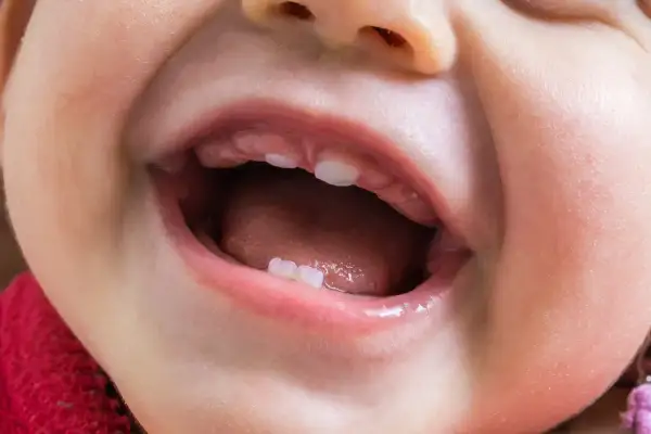 Uśmiechnięte dziecko z kilkoma ząbkami. Zastanawiasz się nad późne ząbkowanie przyczyny?